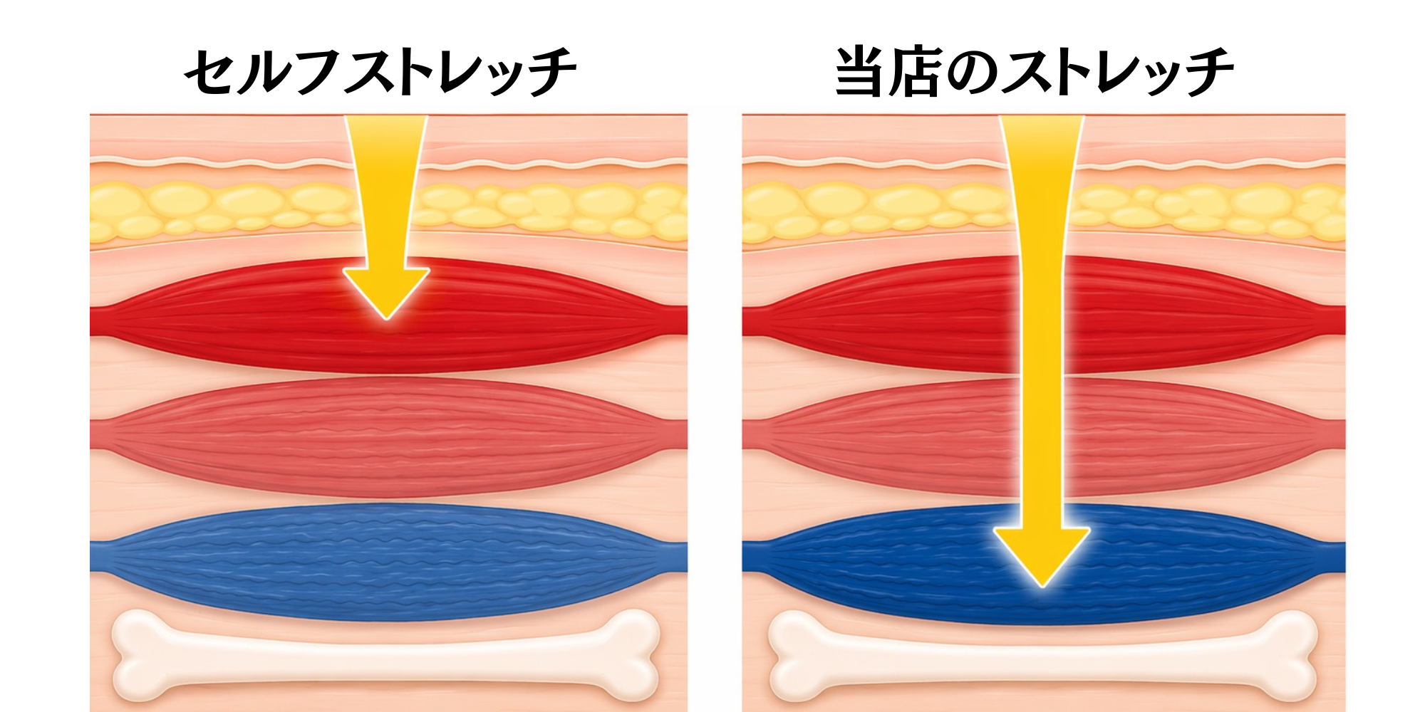 セルフストレッチと当店のストレッチを比較した図