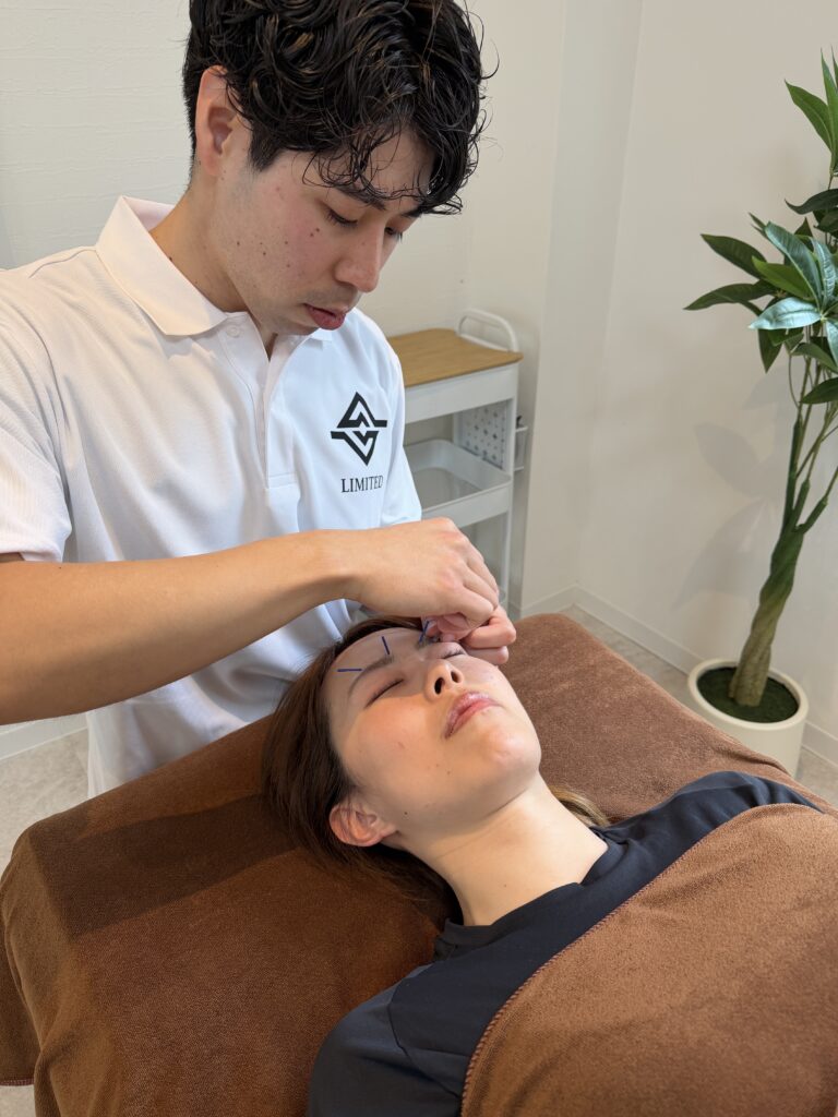 オプションの鍼灸や美容鍼をやっている様子